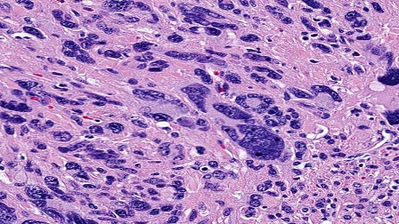 Pleomorphism Versus Monomorphism II