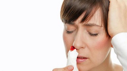 Nose Bleeding